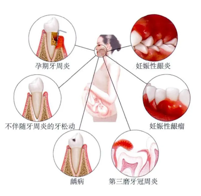 ac89437b-6d45-4e48-af59-17103f2b03be.png